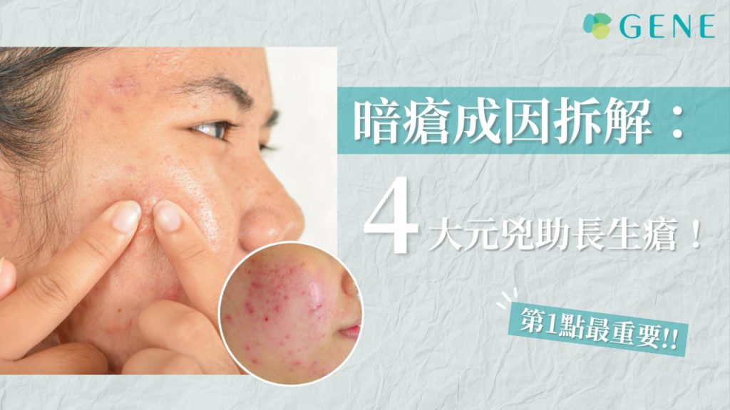 【暗瘡全攻略】剖析暗瘡種類、症狀、位置、成因、治療及預防 - GENE SKIN 柔針清痘專家